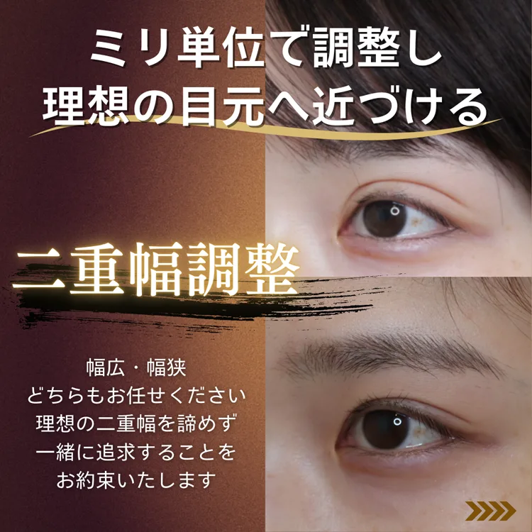 二重幅調整・二重修正