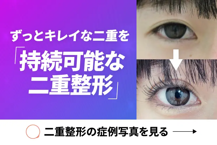 ずっとキレイな二重を持続可能な二重整形