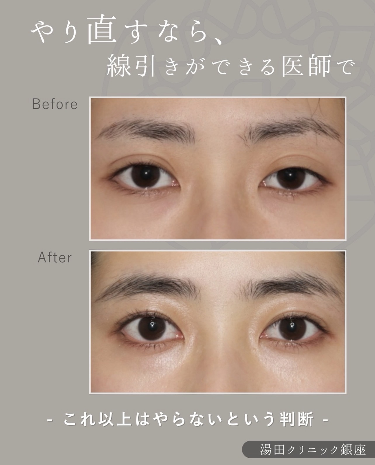 ハム目を治したいのメイン症例写真