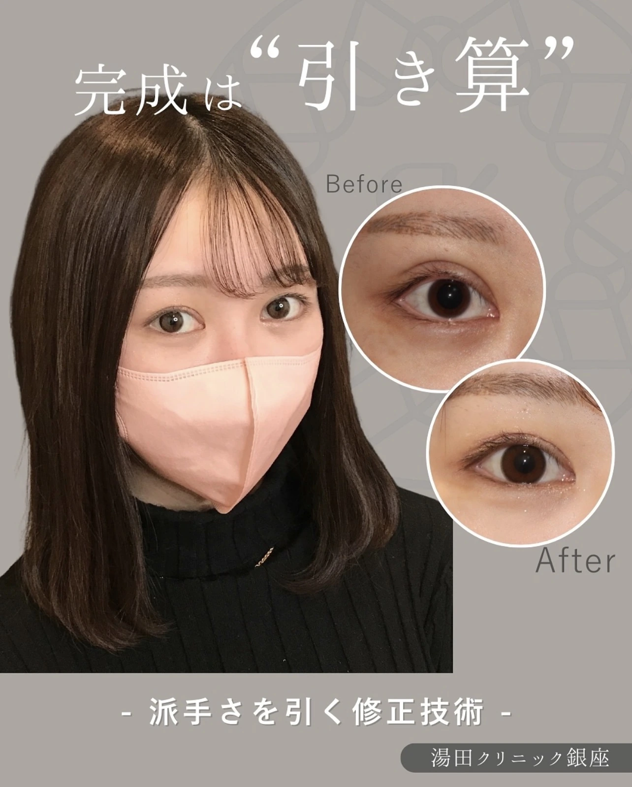 二重修正 CASE 46の術前と術後を含む症例トップ画像
