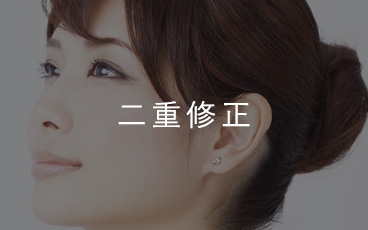 二重修正・他院修正の症例・料金・カウンセリング