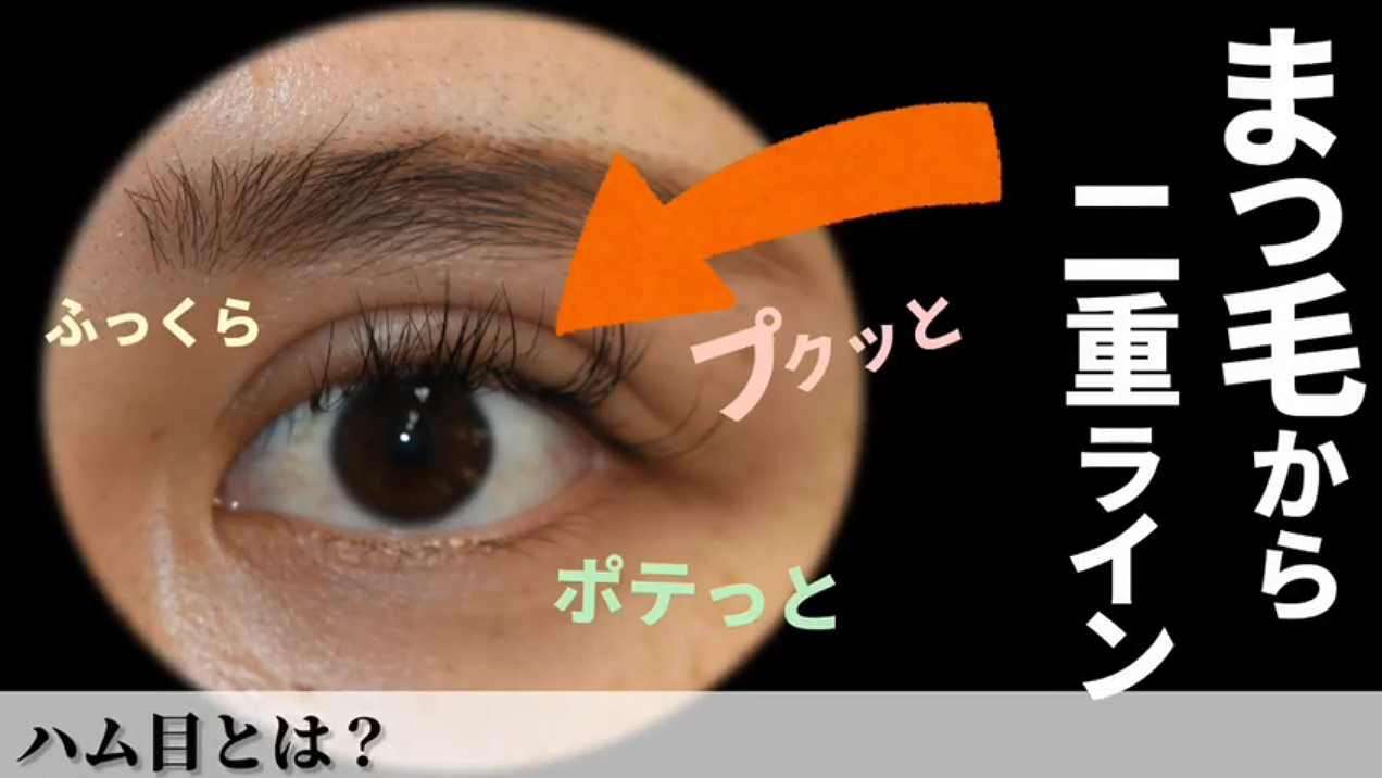 目 の 腫れ を 直す 方法