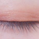 キレイな二重整形ってどのくらい綺麗なの？？美容外科医湯田が詳説。