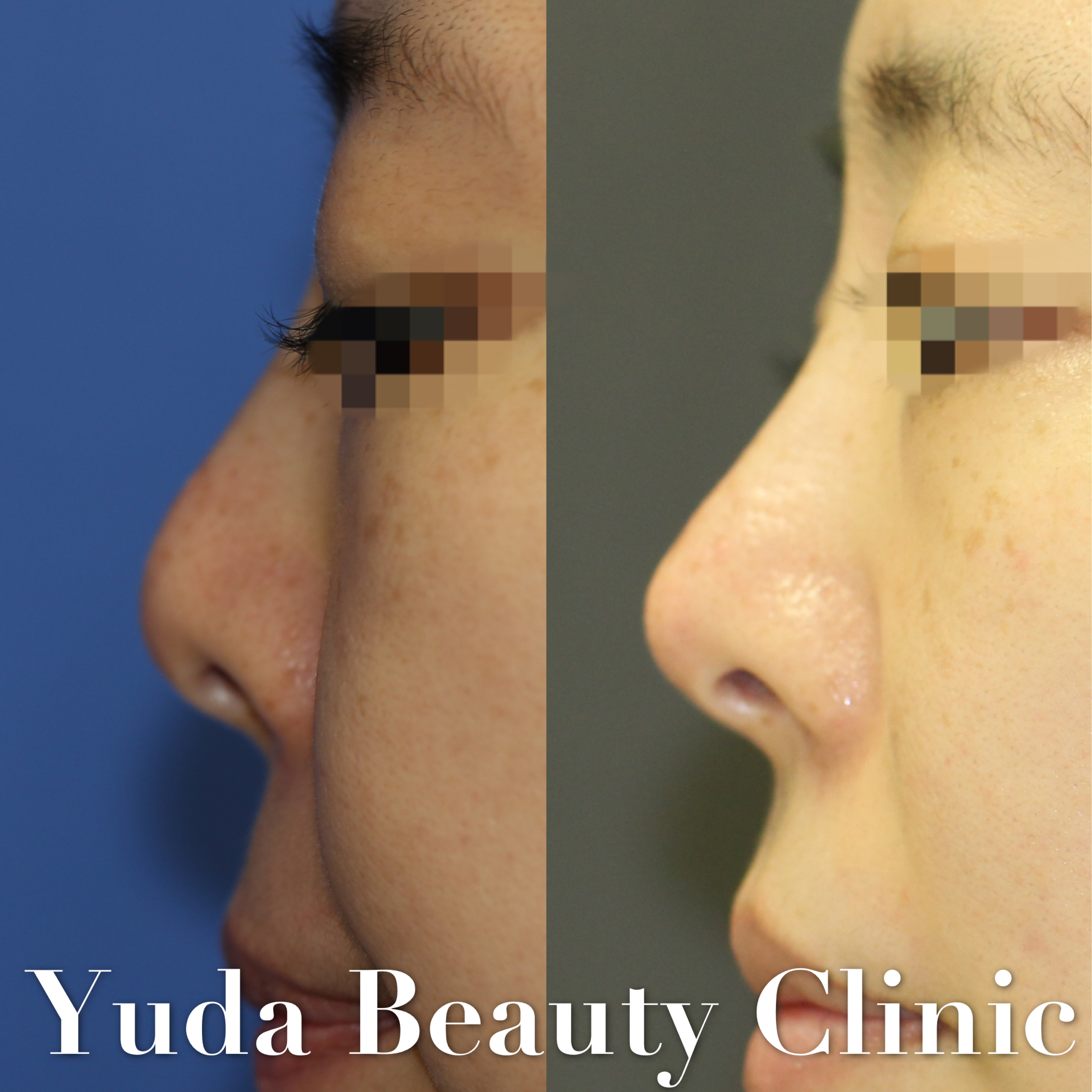 湯田先生の相談室 湯田眼科美容クリニック