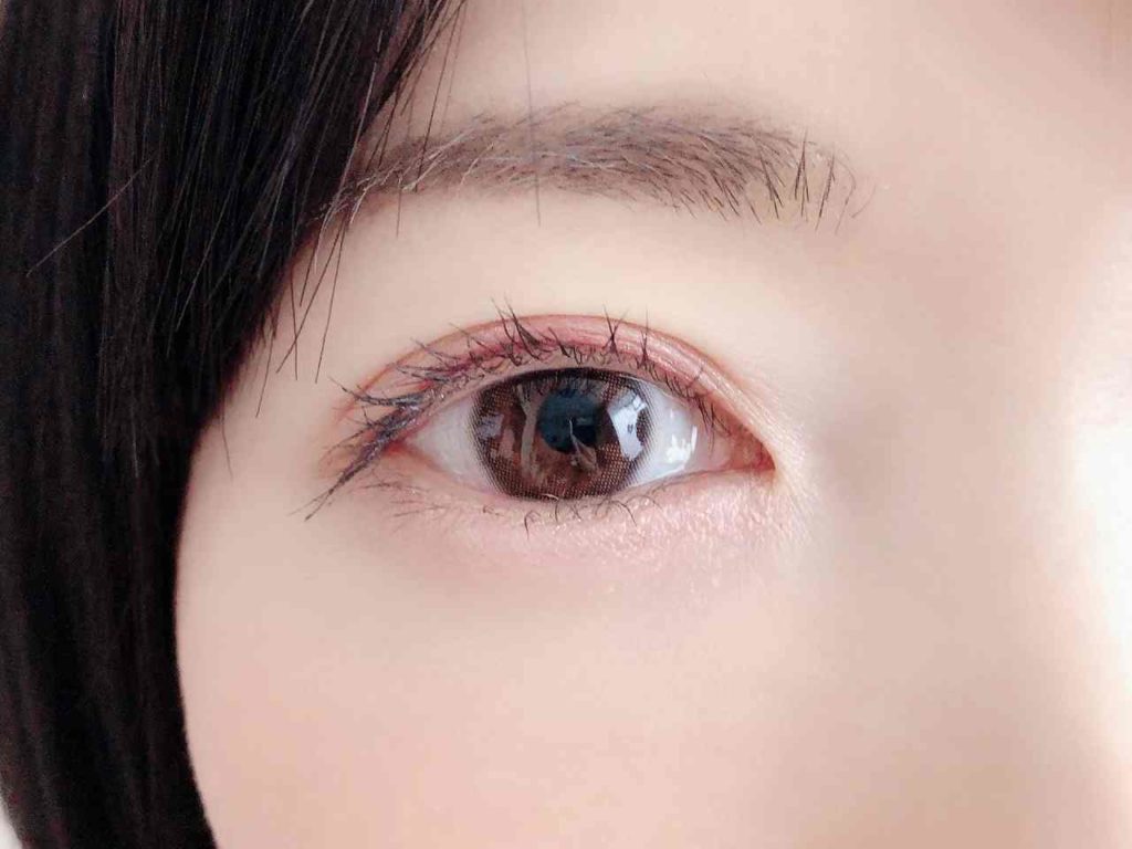 二重整形を片目ずつ、もしくは片目だけやることは可能なのか？【美容外科医湯田講座】
