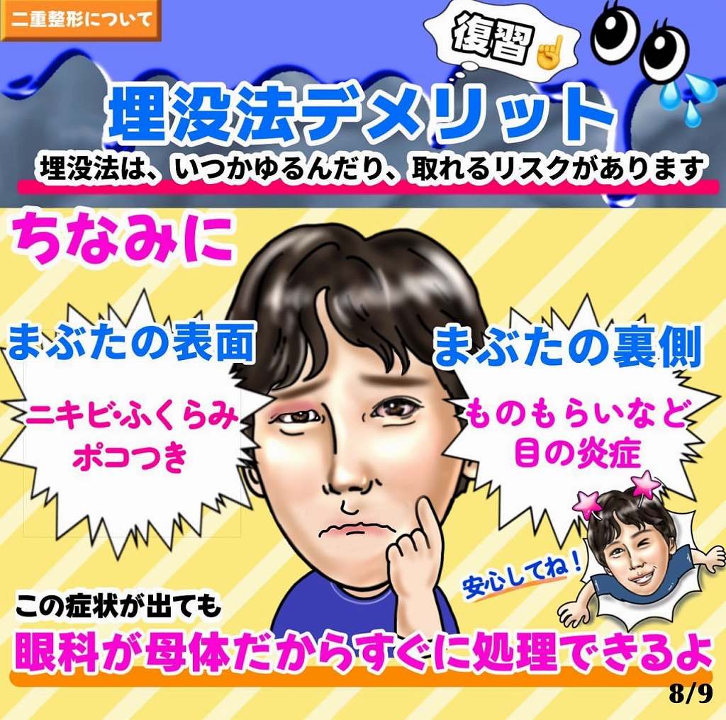 埋没法デメリット