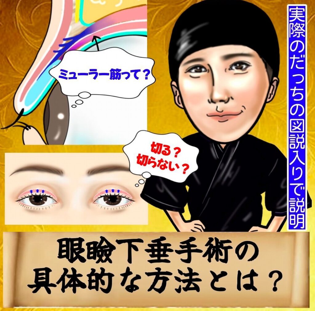 眼瞼下垂とは？症状・原因・手術方法・保険適用について