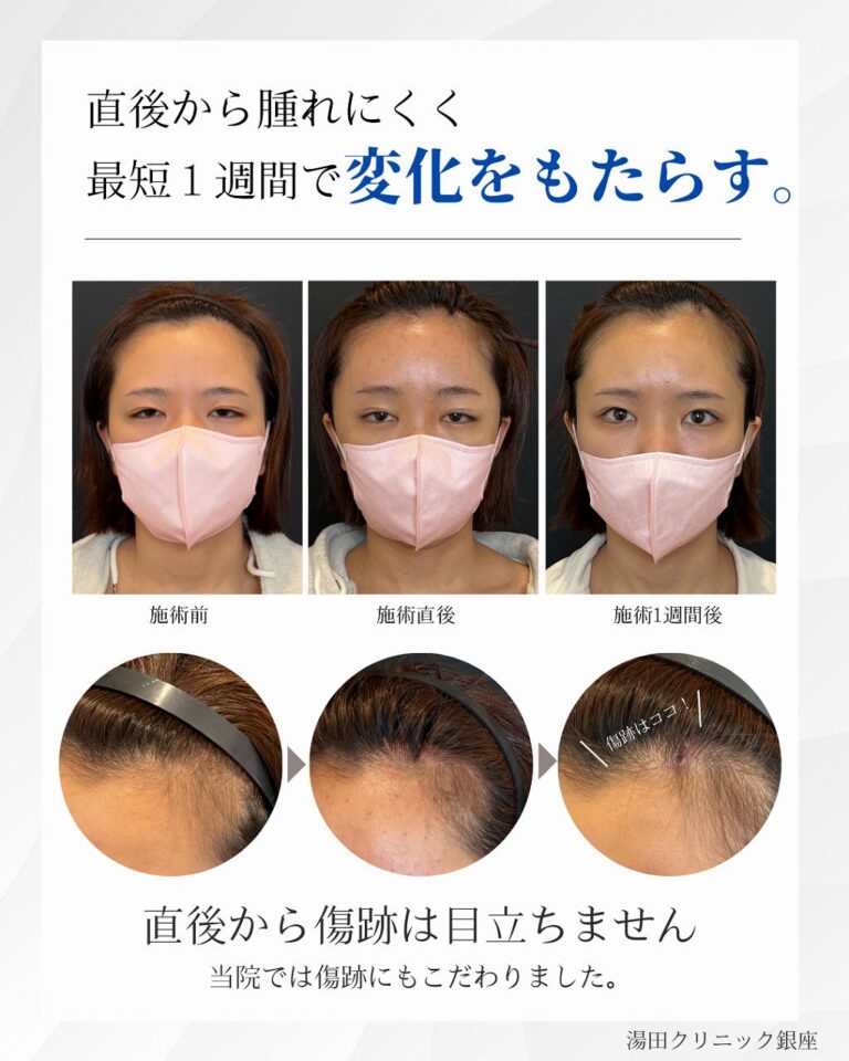 圧縮済み