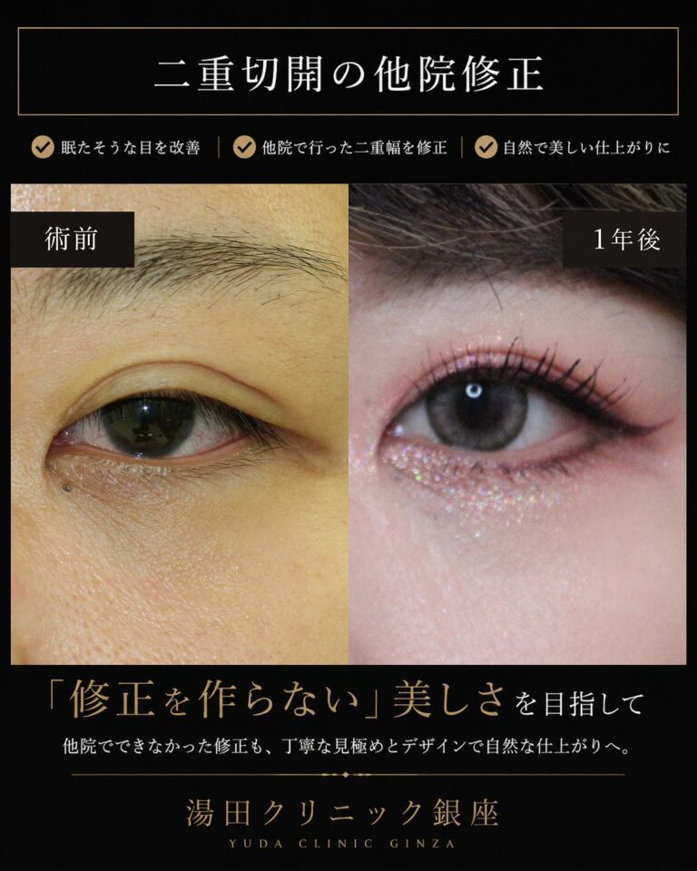 圧済