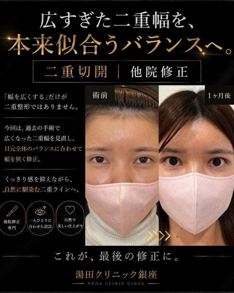 圧済